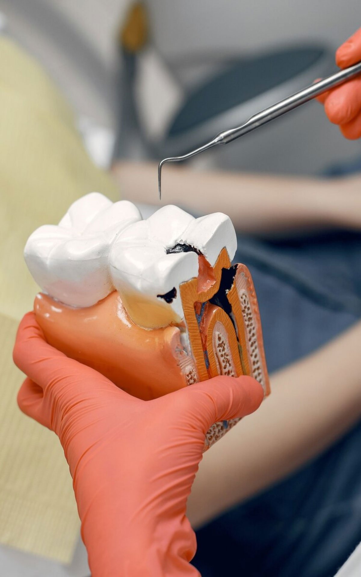 Endodonti – Kanal Tedavisi