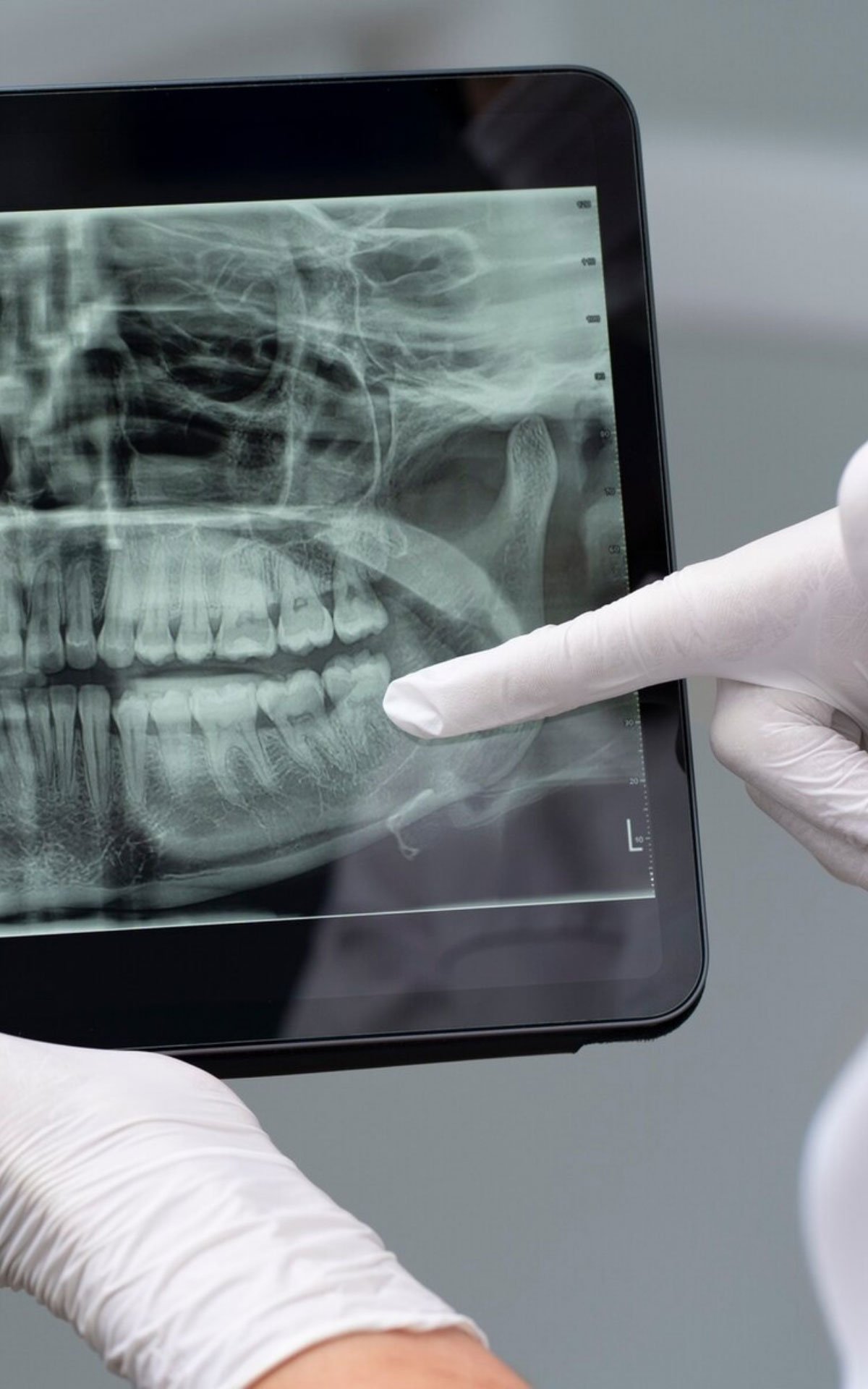 Oral Diagnoz ve Radyoloji